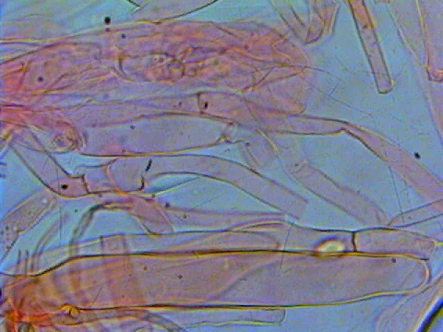 ancora Lepiota (cfr. Lepiota subincarnata)